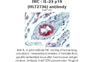 Image no. 2 for anti-Interleukin 23, alpha subunit p19 (IL23A) antibody (ABIN1724064) (IL23A Antikörper)