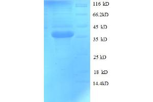 SDS-PAGE (SDS) image for 3-hydroxybutyrate Dehydrogenase, Type 1 (BDH1) (AA 47-343) protein (His tag) (ABIN5709131)