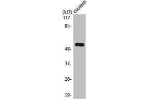 Western Blot analysis of COLO205 cells using LPD lipase Polyclonal Antibody (Lipase I Antikörper  (Internal Region))