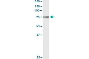 Immunoprecipitation (IP) image for anti-Coagulation Factor II (thrombin) (F2) (AA 263-362) antibody (ABIN560822)