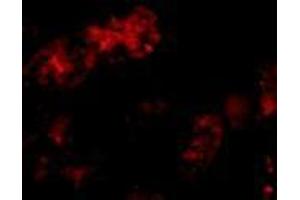 Immunofluorescence of Bmf in human kidney tissue with AP30156PU-N Bmf antibody at 10 μg/ml.