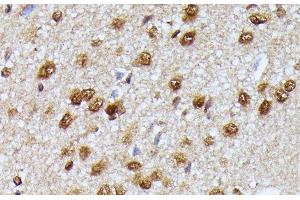 Immunohistochemistry of paraffin-embedded Rat brain using KIAA1429 Polyclonal Antibody at dilution of 1:100 (40x lens). (VIRMA/KIAA1429 Antikörper)