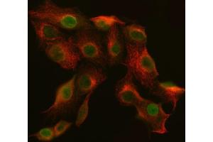 IF analysis of SNF2H/SMARCA5 and Tubulin beta using anti-SNF2H/SMARCA5 antibody (ABIN7600125) and anti-Tubulin beta antibody (ABIN7602744). (ABI2 Antikörper  (AA 151-400))