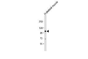 Anti-GAS2L2 Antibody (C-term) at 1:1000 dilution + human skeletal muscle lysate Lysates/proteins at 20 μg per lane. (GAS2L2 Antikörper  (C-Term))