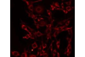 ABIN6275100 staining HeLa by IF/ICC. (CD39 Antikörper  (Internal Region))