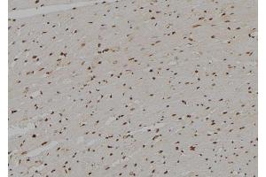 Immunohistochemistry (IHC) image for anti-Amyloid beta (A4) Precursor Protein-Binding, Family B, Member 2 (APBB2) (Internal Region) antibody (ABIN6257935)