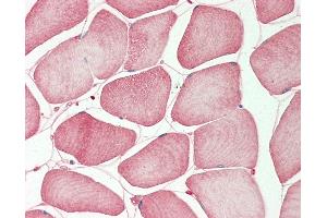 Human Skeletal Muscle: Formalin-Fixed, Paraffin-Embedded (FFPE). (TMPRSS3 Antikörper  (N-Term))