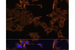 Immunofluorescence analysis of C6 cells using PDGFR beta Polyclonal Antibody at dilution of 1:100. (PDGFRB Antikörper)