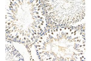 ABIN6257905 and ABIN6274686 at 1/100 staining Rat testis tissue by IHC-P. (Exonuclease 1 Antikörper  (N-Term))