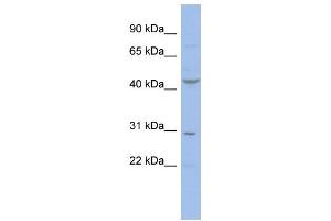 WB Suggested Anti-CCNE2 Antibody Titration:  0. (Cyclin E2 Antikörper  (N-Term))