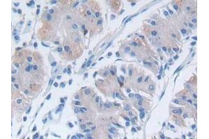 DAB staining on IHC-P; Samples: Human Stomach Tissue (DPP7 Antikörper  (AA 28-486))