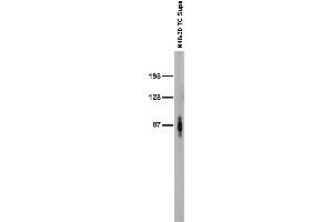 Adult rat brain membrane immunoblot. (ADAM22 Antikörper  (Cytosolic))