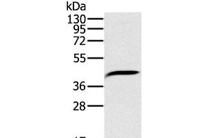 Western Blot analysis of Hela cell using PDSS2 Polyclonal Antibody at dilution of 1:200 (PDSS2 Antikörper)