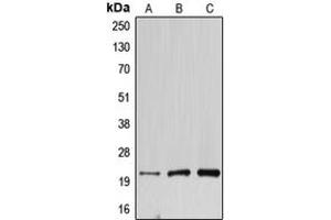 Western blot analysis of DNAL1 expression in HEK293T (A), mouse testis (B), rat kidney (C) whole cell lysates. (DNAL1 Antikörper  (Center))