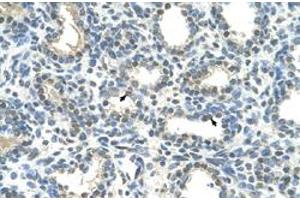 Immunohistochemical staining (Formalin-fixed paraffin-embedded sections) of human lung with HOXC9 polyclonal antibody  at 4-8 ug/mL working concentration. (HOXC9 Antikörper  (Internal Region))