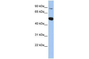 WB Suggested Anti-SOX6 Antibody Titration: 0. (SOX6 Antikörper  (Middle Region))