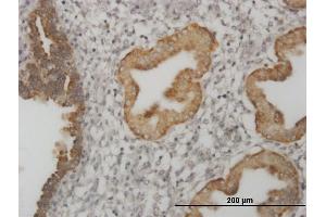 Immunoperoxidase of monoclonal antibody to MSI1 on formalin-fixed paraffin-embedded human endometrium. (MSI1 Antikörper  (AA 190-273))