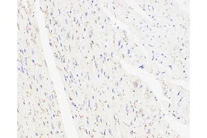 Immunohistochemistry analysis of paraffin-embedded mouse heart using Connexin 43 Polyclonal Antibody at dilution of 1:300. (Connexin 43/GJA1 Antikörper)
