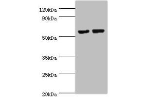 Western blot All lanes: MATN3 antibody at 14 μg/mL Lane 1: NIH/3T3 whole cell lysate Lane 2: Mouse thymus tissue Secondary Goat polyclonal to rabbit IgG at 1/10000 dilution Predicted band size: 53, 49 kDa Observed band size: 53 kDa (Matrilin 3 Antikörper  (AA 277-486))