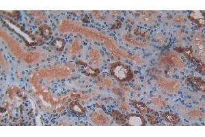 Detection of S100 in Human Kidney Tissue using Polyclonal Antibody to S100 Calcium Binding Protein (S100)