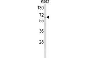 Western Blotting (WB) image for anti-Cytochrome P450, Family 4, Subfamily F, Polypeptide 3 (CYP4F3) antibody (ABIN3003849) (CYP4F3 Antikörper)