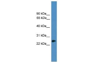WB Suggested Anti-ZNF313 Antibody Titration:  0. (RNF114 Antikörper  (C-Term))