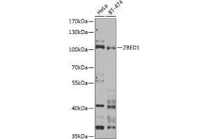 Western blot analysis of extracts of various cell lines, using ZBED1 Antibody (ABIN6132791, ABIN6150363, ABIN6150364 and ABIN6222539) at 1:1000 dilution. (ZBED1 Antikörper  (AA 1-280))