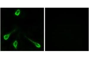 Immunofluorescence analysis of LOVO cells, using OR52E4 Antibody. (OR52E4 Antikörper  (AA 200-249))