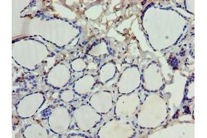Immunohistochemistry of paraffin-embedded human thyroid tissue using ABIN7168881 at dilution of 1:100 (SDSL Antikörper  (AA 39-169))