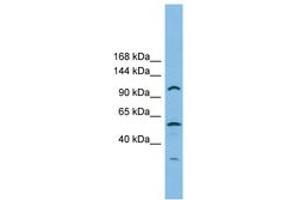 Image no. 1 for anti-CTF18, Chromosome Transmission Fidelity Factor 18 Homolog (CHTF18) (AA 791-840) antibody (ABIN6745170)