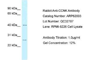 Western Blotting (WB) image for anti-Cyclin K (CCNK) (Middle Region) antibody (ABIN2788983)