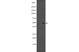 Western blot analysis of SOX4 expression in Hela cell lysate,The lane on the left is treated with the antigen-specific peptide. (SOX4 Antikörper  (C-Term))