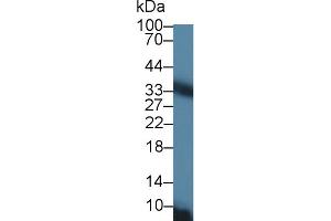 Western Blot; Sample: Rat Liver lysate; Primary Ab: 1µg/ml Rabbit Anti-Rat CACT Antibody Second Ab: 0. (SLC25A20 Antikörper  (AA 1-211))