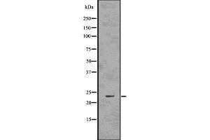 Western blot analysis of Rab10 using COLO205 whole cell lysates (RAB10 Antikörper  (C-Term))