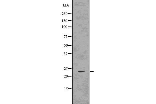 RAB10 Antikörper  (C-Term)