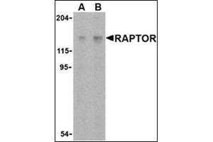 Western blot analysis of Raptor in L1210 cell lysate with this product at (A) 2 and (B) 4 μg/ml. (RAPTOR Antikörper  (C-Term))