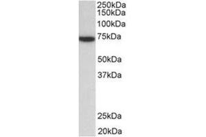 Western Blotting (WB) image for anti-zeta-Chain (TCR) Associated Protein Kinase 70kDa (ZAP70) (Internal Region) antibody (ABIN1109533) (ZAP70 Antikörper  (Internal Region))