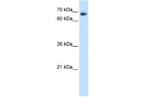 Western Blotting (WB) image for anti-TAF6 RNA Polymerase II, TATA Box Binding Protein (TBP)-Associated Factor, 80kDa (TAF6) (N-Term) antibody (ABIN2775955)