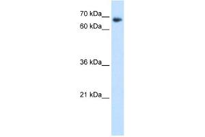 WB Suggested Anti-TAF6 Antibody Titration:  1. (TAF6 Antikörper  (N-Term))