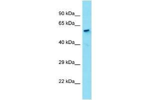 Host:  Rabbit  Target Name:  HDAC1  Sample Type:  Liver Tumor lysates  Antibody Dilution:  1. (HDAC1 Antikörper  (N-Term))