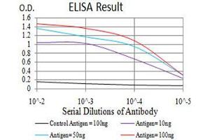 Black line: Control Antigen (100 ng),Purple line: Antigen (10 ng), Blue line: Antigen (50 ng), Red line:Antigen (100 ng) (GFPT1 Antikörper  (AA 536-681))
