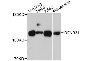 Western blot analysis of extracts of various cell lines, using WHRN antibody. (DFNB31 Antikörper  (AA 708-907))