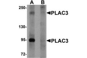 Western blot analysis of PLAC3 in HeLa cell lysate with PLAC3 antibody at 1 μg/ml in (A) the absence and (B) the presence of blocking peptide. (PAPPA2 Antikörper  (N-Term))