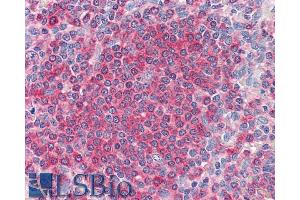 ABIN238677 (5µg/ml) staining of paraffin embedded Human Spleen. (FZD7 Antikörper  (C-Term))
