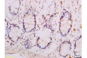 Formalin-fixed and paraffin embedded human rectal tissue labeled with Anti-Adiponectin Receptor 1 Polyclonal Antibody , Unconjugated at 1:300, followed by conjugation to the secondary antibody and DAB staining (Adiponectin Receptor 1 Antikörper  (AA 241-270))