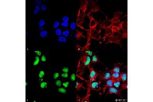 Immunocytochemistry/Immunofluorescence analysis using Rabbit Anti-Choline Acetyltransferase Polyclonal Antibody . (Choline Acetyltransferase Antikörper  (N-Term) (HRP))