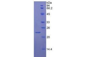 SDS-PAGE analysis of Rat vWF Protein. (VWF Protein)