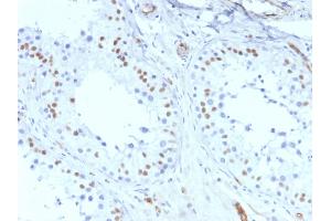 ABIN6383829 to WT1 was successfully used to stain nuclei in sections of human mesothelioma and in human and rat testis sections. (Rekombinanter WT1 Antikörper)