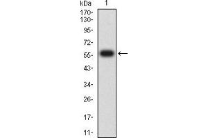 Western blot analysis using CD1C mAb against human CD1C (AA: extra 18-302) recombinant protein. (CD1c Antikörper  (AA 18-302))