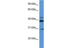 Image no. 1 for anti-Vasodilator-Stimulated phosphoprotein (VASP) (AA 127-176) antibody (ABIN6746957) (VASP Antikörper  (AA 127-176))
